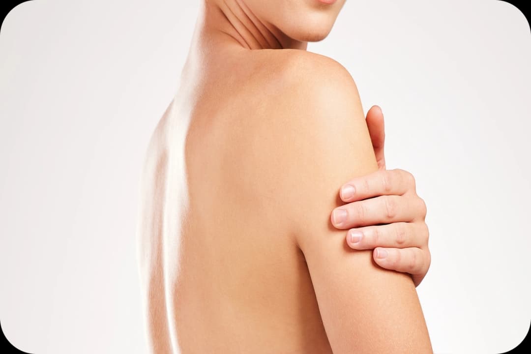 Laserová epilácia ramien Košice